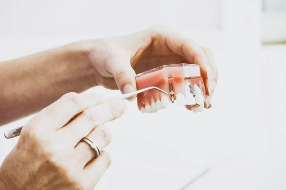 Dentist holding a model of teeth