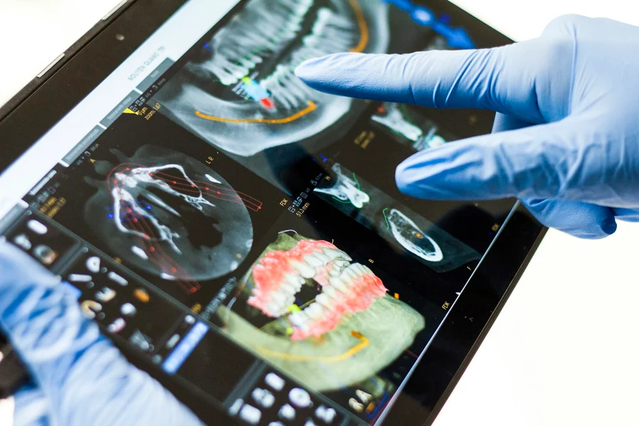 Dentist reviewing a 3D dental scan on a tablet