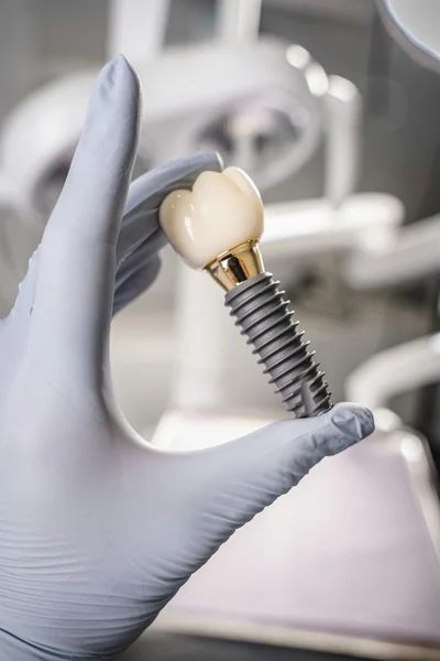 Gloved hand holding a dental implant and crown