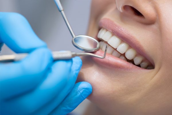 Smile Club | Dentist in Cheadle Hulme | General Dentistry