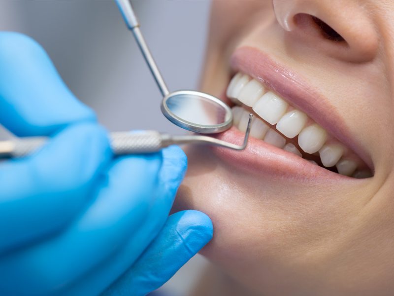 Smile Club | Dentist in Cheadle Hulme | General Dentistry